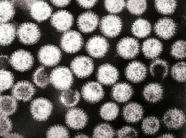 这种疫苗可能与1型糖尿病的减少有关