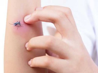 为什么蚊子叮咬会痒?